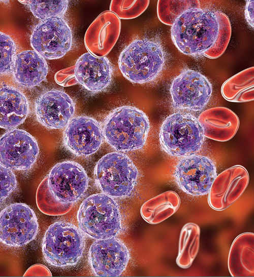 Detail aus Maligne Lymphome (2019)